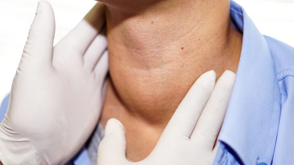 hyperthyroidism